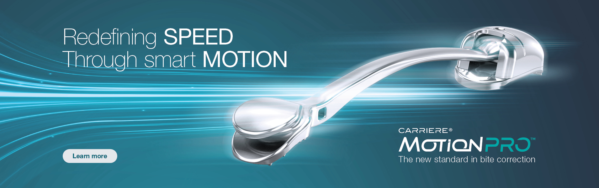 Carriere Motion Pro